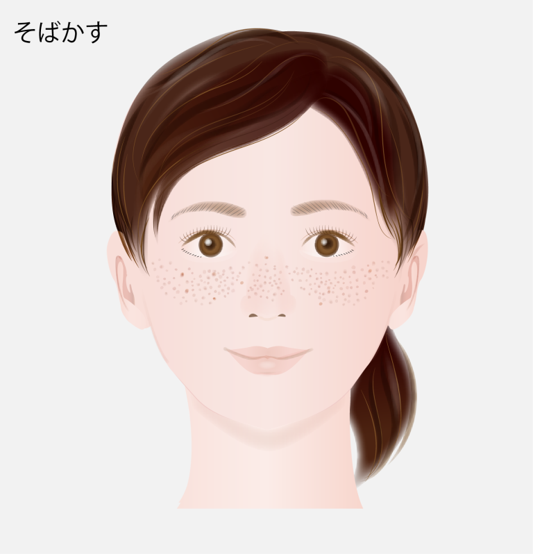 雀卵斑（じゃくらんはん）